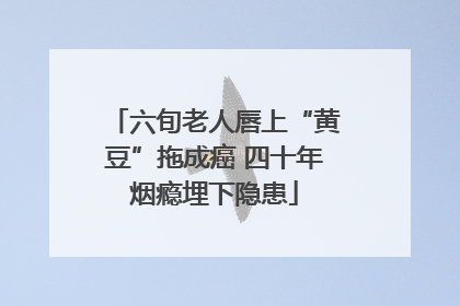 六旬老人唇上“黄豆”拖成癌 四十年烟瘾埋下隐患
